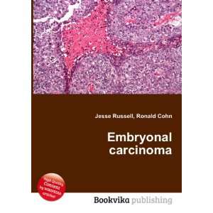  Embryonal carcinoma Ronald Cohn Jesse Russell Books