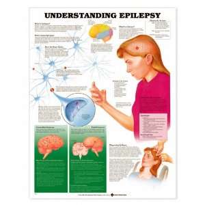 Understanding Epilepsy Chart  Industrial & Scientific