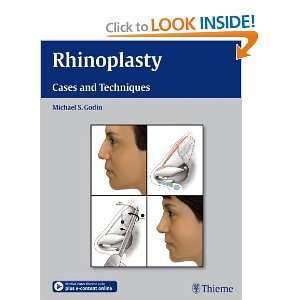   Rhinoplasty Cases and Techniques [Hardcover] Michael S. Godin Books