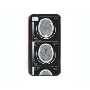  iPhone 4/4s Case Brain Scan X Ray Cell Phones 