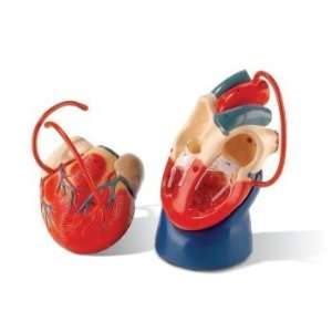  Coronary Bypass Heart Model