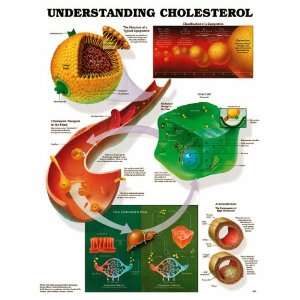 Understanding Cholesterol Anatomical Chart Paper Unmounted  